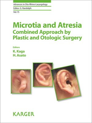 cover image of Microtia and Atresia--Combined Approach by Plastic and Otologic Surgery